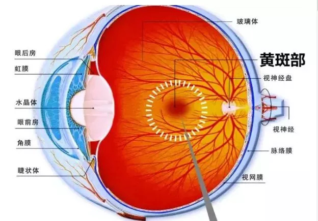 眼底黃斑病變最新最有效的治療方法探討