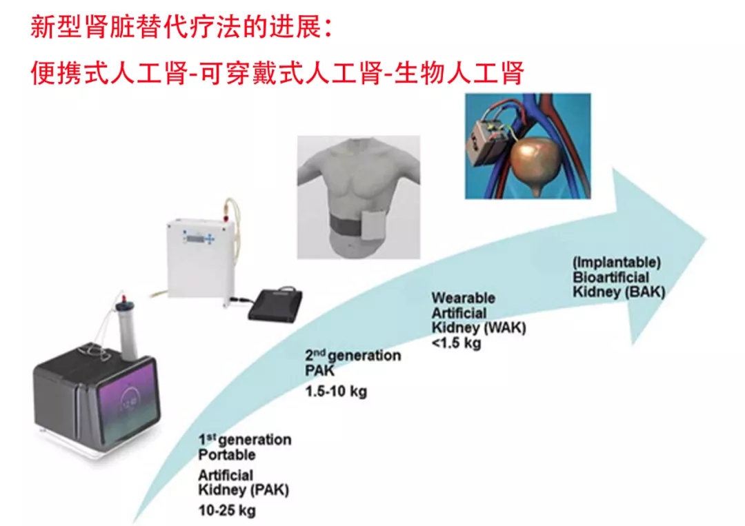 最新人工腎技術，重塑腎臟健康的新希望之旅